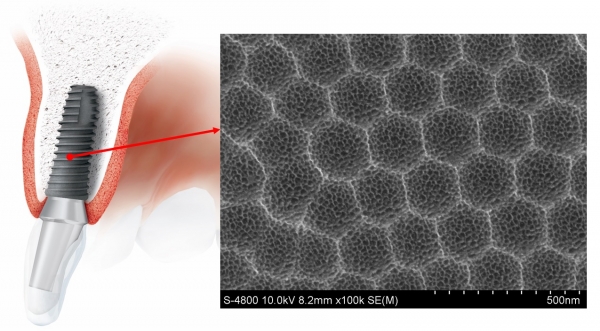 치과용 임플란트 및 임플란트 표면 현미경 사진. (사진=전기연구원)