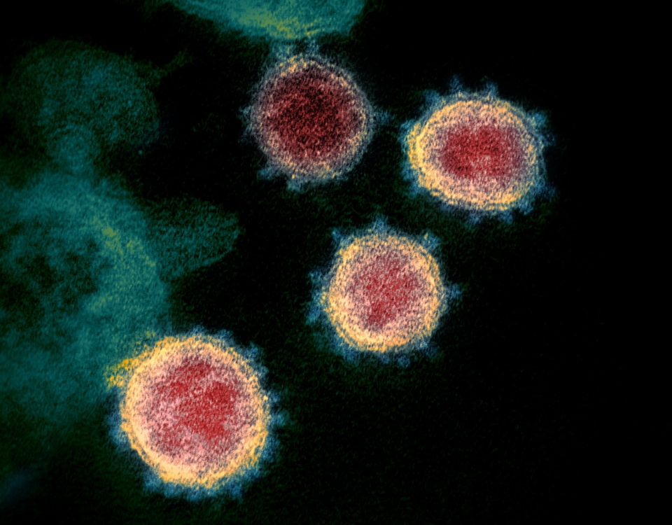 SARS-CoV-2 바이러스 입자의 전자현미경 사진(출처:위키피디아)