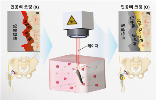 KIST 연구진이 레이저를 이용하여 인골 뼈를 세계 최고속 수준으로 구현한 방법과 이로 인해 형성된 코팅층의 구조를 보여주는 모식도. (사진=KIST)